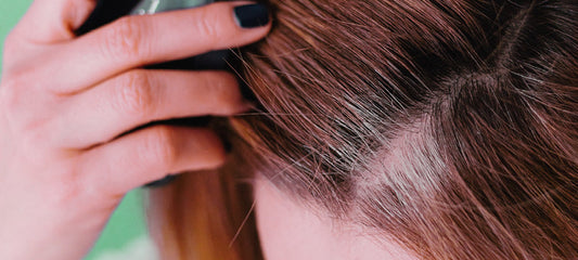 Seasonal Hair Loss and What You Can Do About It